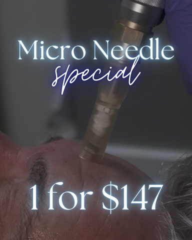 Microneedling 3 Treatments for $147