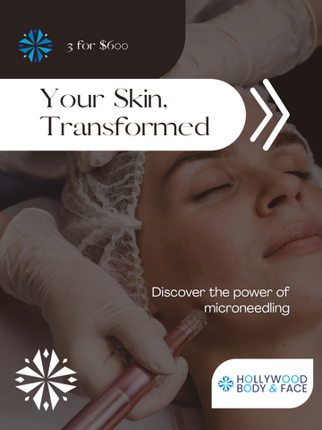 Microneedling 3 Treatments for $600