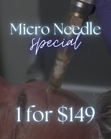 Microneedling 1 Treatments for $149