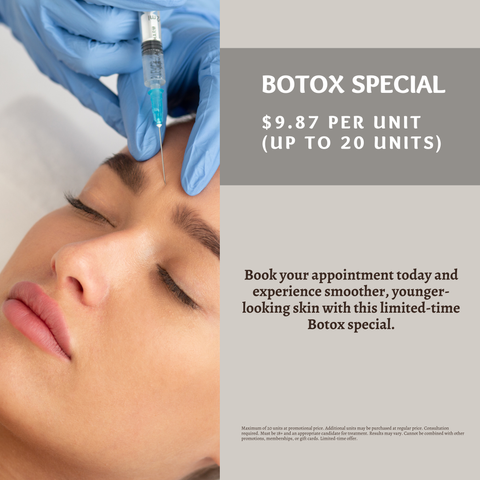 Botox – 20 Units (Max) | $9.87 Per Unit