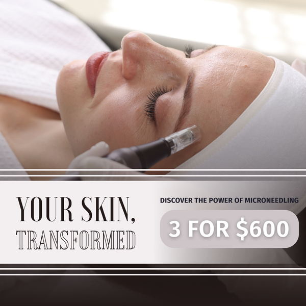 Microneedling 3 Treatments for $600